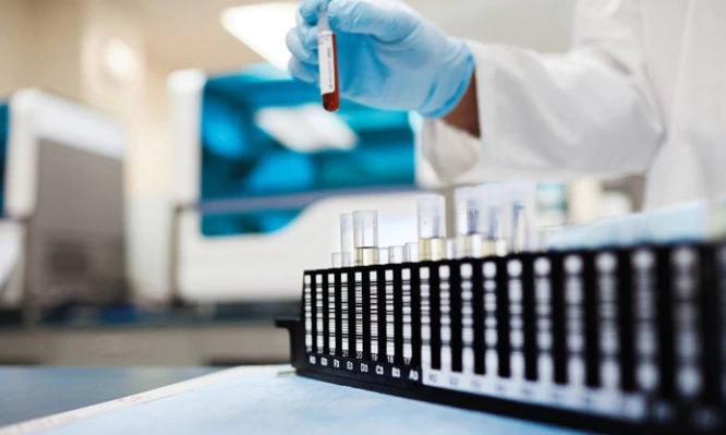 Διαγνωστικά κέντρα: Το τέλος των κινητοποιήσεων και η ικανοποίηση των αιτημάτων